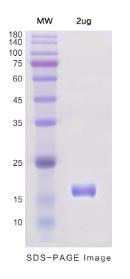 SDS-PAGE (PRNP-6005H).jpg